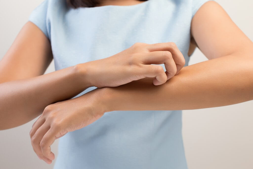 Ayudando a restablecer la salud de la piel, la dermatitis atópica